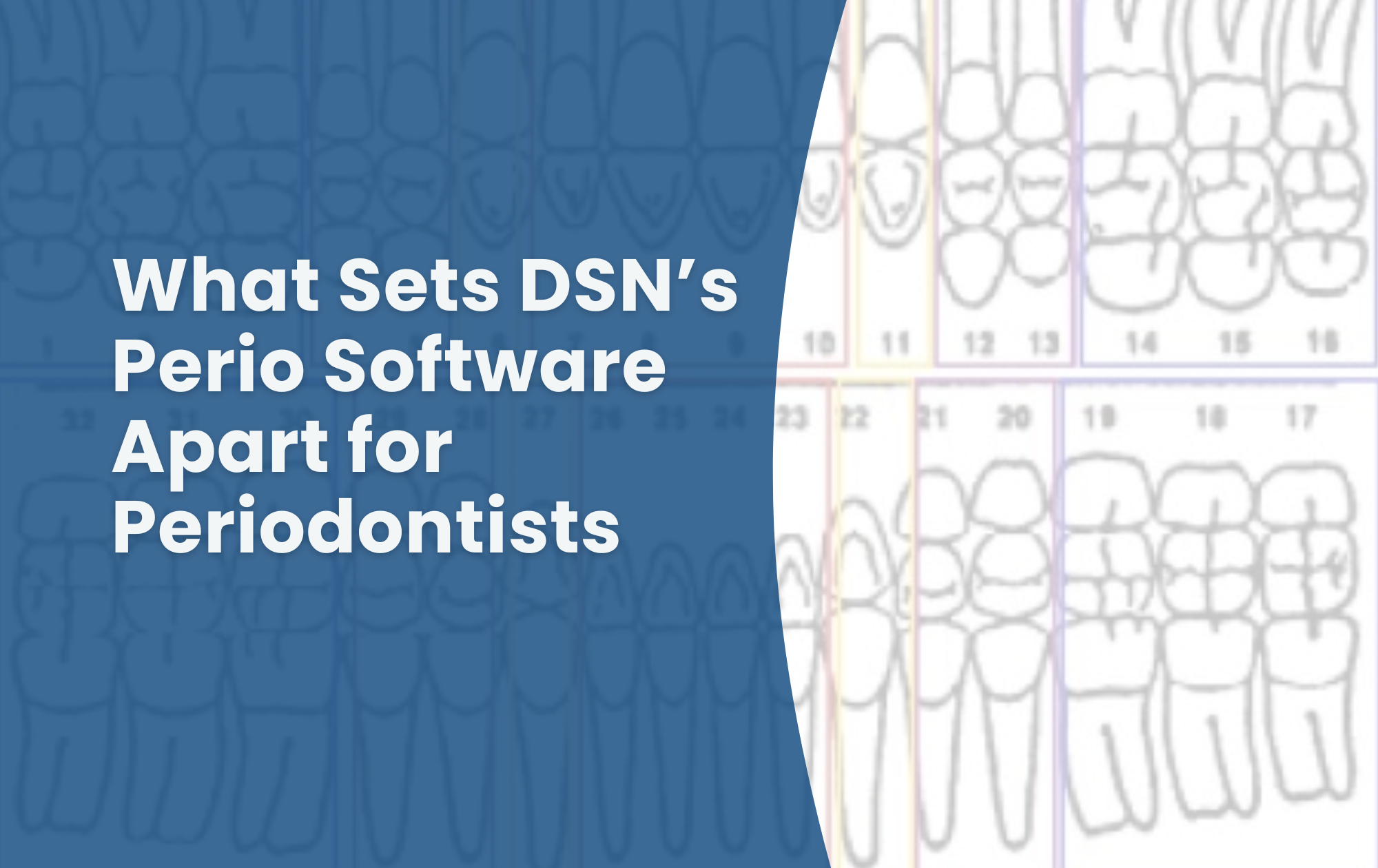 graphic with text that reads: what sets DSN's perio software apart for periodontists