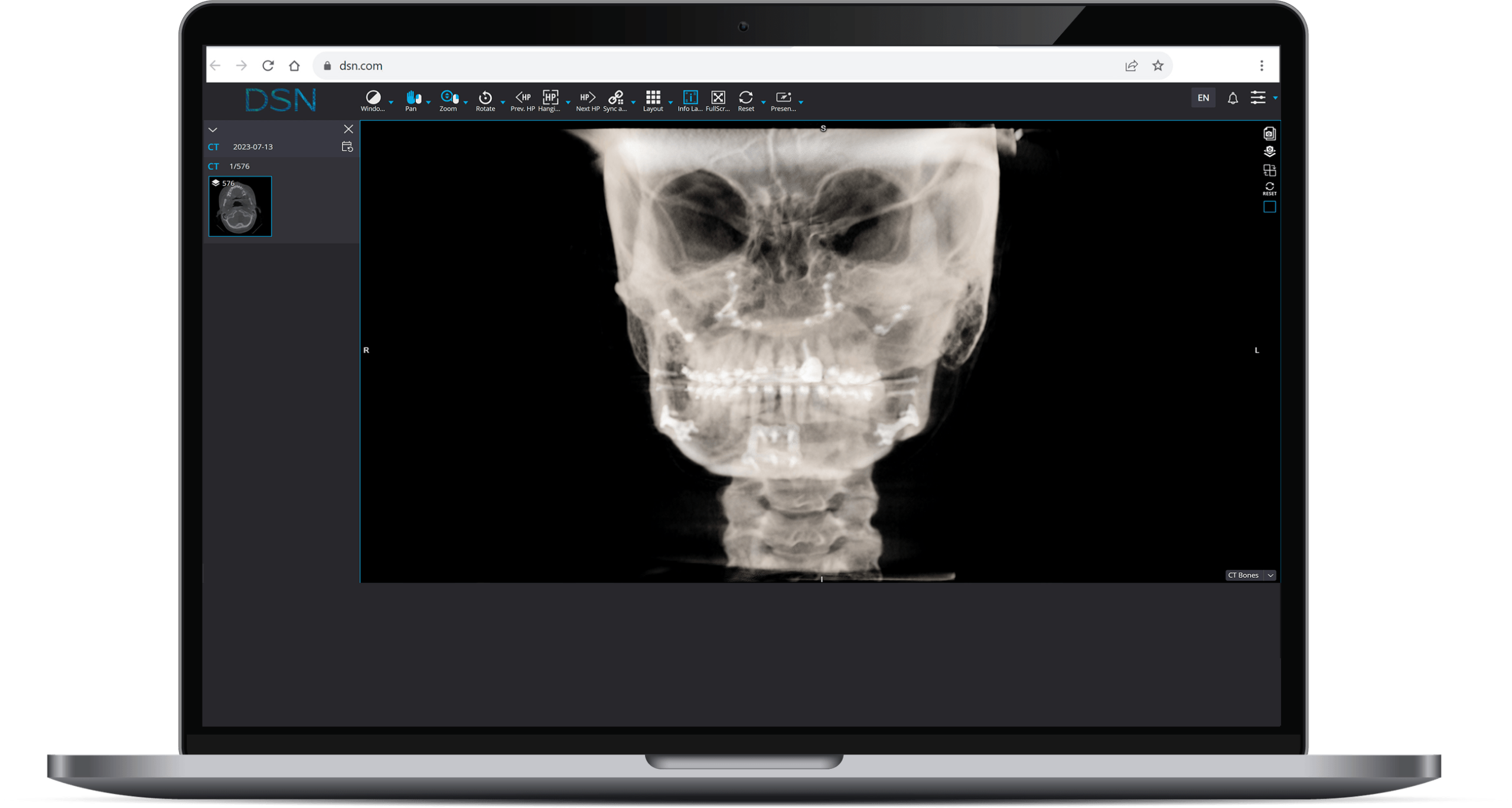 DSN Imaging